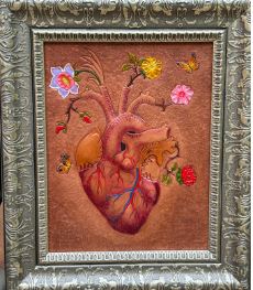 Listen by Miquel A. Vazquez, MD
